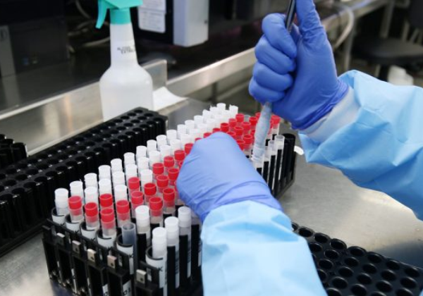 BA atinge 31.217 casos ativos e 5 �bitos s�o registrados nas �ltimas 24h